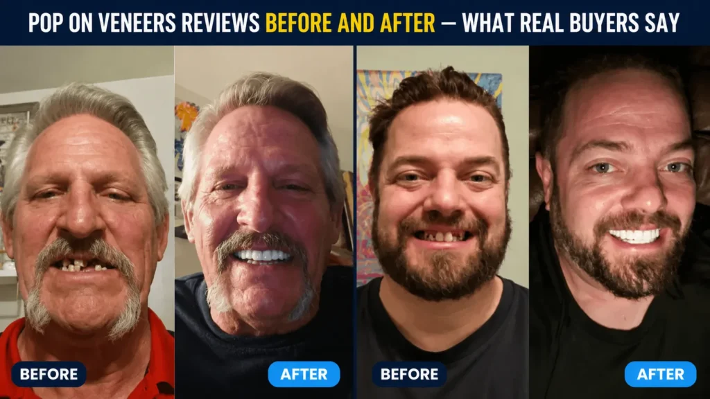 Pop On Veneers Reviews Before and After