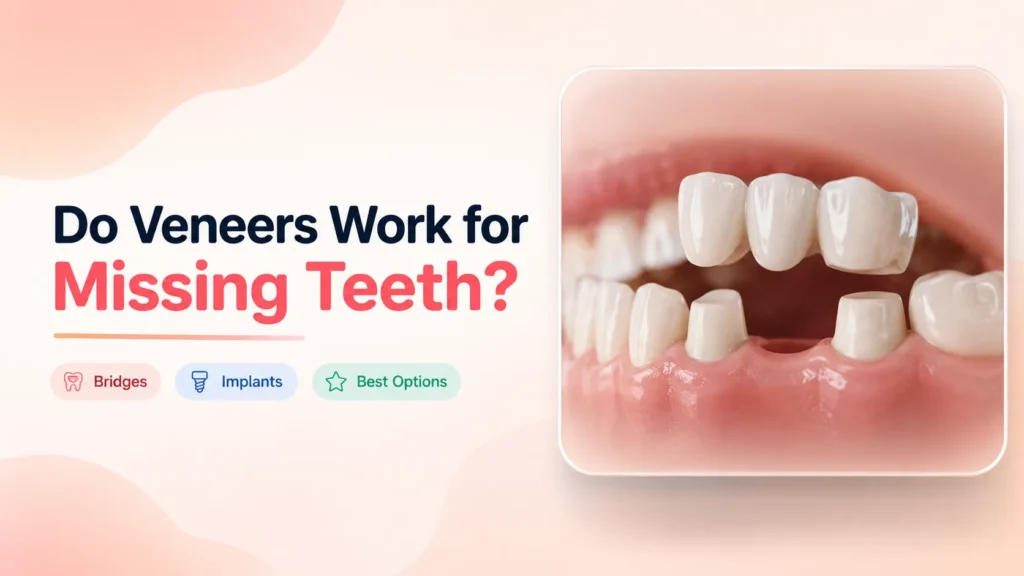 Do Veneers Work for Missing Teeth