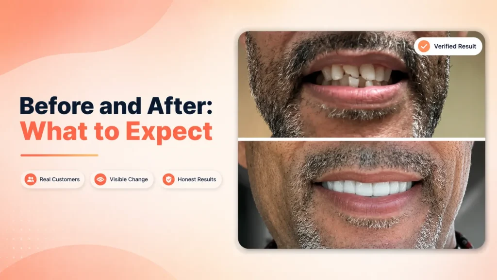 Removable Veneers Reviews Before and After